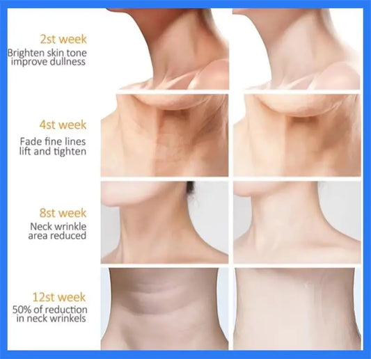 Neck Firming Cream – Anti-Aging, Wrinkle Repair & Whitening | 30g