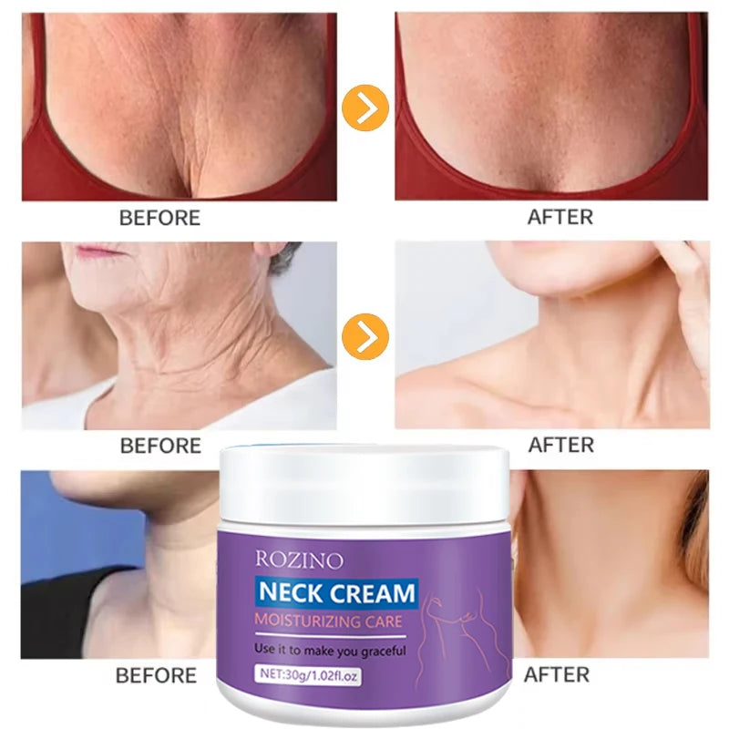 Neck Firming Cream – Anti-Aging, Wrinkle Repair & Whitening | 30g
